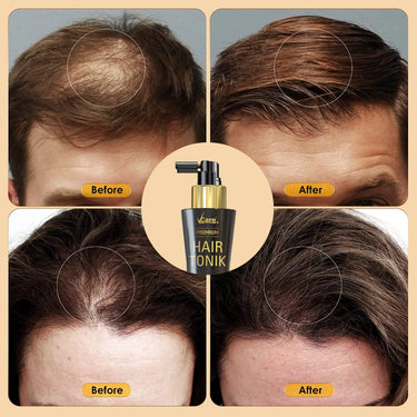 VCare Day Night Hair Tonic For Men & Women with Castor Oil and Olive Leaf Extract-Best Scalp Serum for All Hair Type-Prevents Hair Fall & Strengthens Hair Stimulates (100ml Pack of 1)